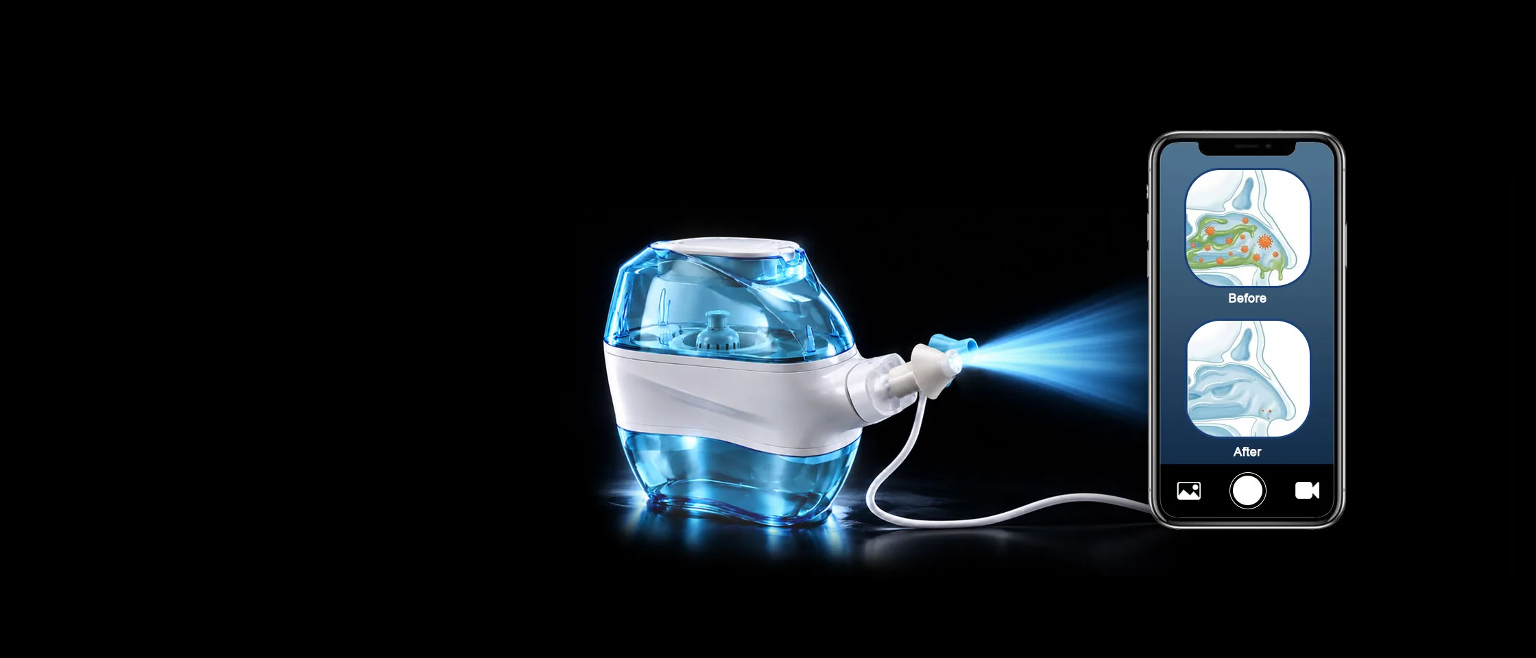 Electric Nasal Irrigator